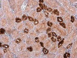 Invitrogen Calbindin D28K Polyclonal Antibody 100 &mu;L; Unconjugated:Antibodies,