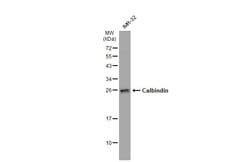 Invitrogen Calbindin D28K Polyclonal Antibody 100 &mu;L; Unconjugated:Antibodies,