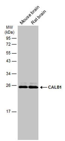 Invitrogen Calbindin D28K Polyclonal Antibody 100 &mu;L; Unconjugated:Antibodies,
