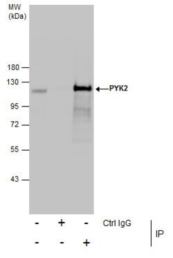 Invitrogen PYK2 Polyclonal Antibody 100 &mu;L; Unconjugated:Antibodies,