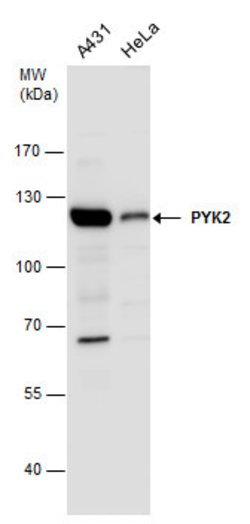 Invitrogen PYK2 Polyclonal Antibody 100 &mu;L; Unconjugated:Antibodies,