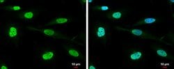 Invitrogen DHX9 Polyclonal Antibody 100 &mu;L; Unconjugated:Antibodies,