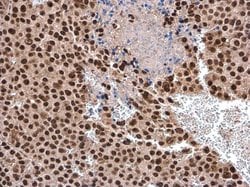 Invitrogen DHX9 Polyclonal Antibody 100 &mu;L; Unconjugated:Antibodies,