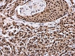 Invitrogen DHX9 Polyclonal Antibody 100 &mu;L; Unconjugated:Antibodies,