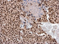 Invitrogen DHX9 Polyclonal Antibody 100 &mu;L; Unconjugated:Antibodies,