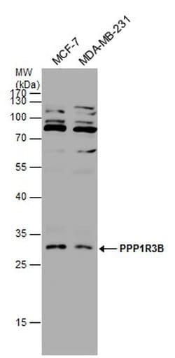 Invitrogen PPP1R3B Polyclonal Antibody 100 &mu;L; Unconjugated:Antibodies,