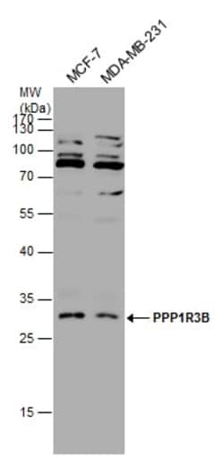 Invitrogen PPP1R3B Polyclonal Antibody 100 &mu;L; Unconjugated:Antibodies,
