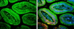 Invitrogen PLEKHA7 Polyclonal Antibody 100 &mu;L; Unconjugated:Antibodies,