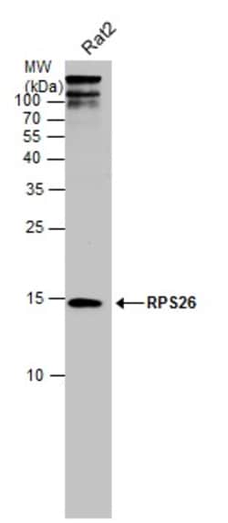Invitrogen RPS26 Polyclonal Antibody 100 &mu;L; Unconjugated:Antibodies,