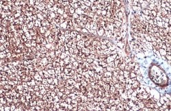 Invitrogen UCP1 Polyclonal Antibody 100 &mu;L; Unconjugated:Antibodies,