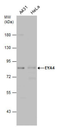 Invitrogen EYA4 Polyclonal Antibody 100 &mu;L | Buy Online | Invitrogen&trade; | Fisher Scientific