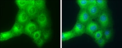 SLK Polyclonal Antibody:Antibodies, Polyclonal
