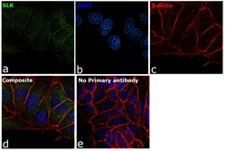 SLK Polyclonal Antibody:Antibodies, Polyclonal