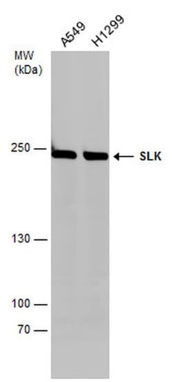 SLK Polyclonal Antibody:Antibodies, Polyclonal