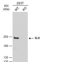 SLK Polyclonal Antibody:Antibodies, Polyclonal