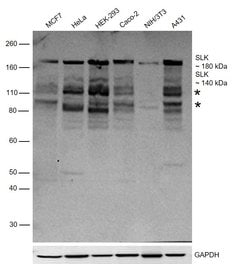 SLK Polyclonal Antibody:Antibodies, Polyclonal