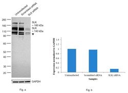 SLK Polyclonal Antibody:Antibodies, Polyclonal