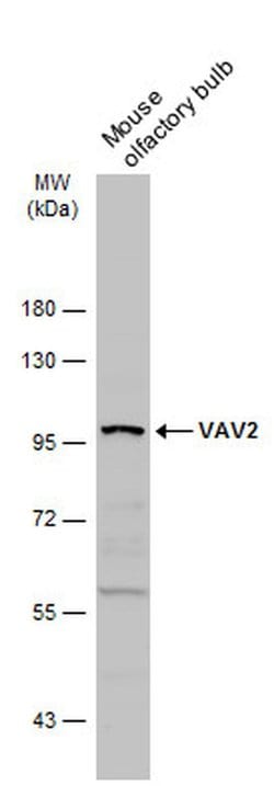 Invitrogen VAV2 Polyclonal Antibody 100 &mu;L; Unconjugated:Antibodies,