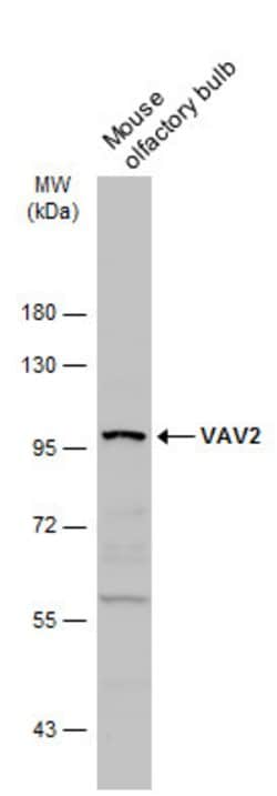 Invitrogen VAV2 Polyclonal Antibody 100 &mu;L; Unconjugated:Antibodies,