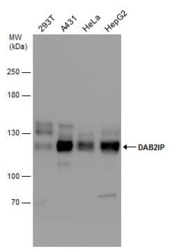 Invitrogen DAB2IP Polyclonal Antibody 100 &mu;L; Unconjugated:Antibodies,