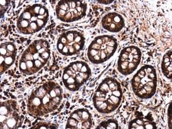 Invitrogen LIN28B Polyclonal Antibody 100 &mu;L; Unconjugated:Antibodies,