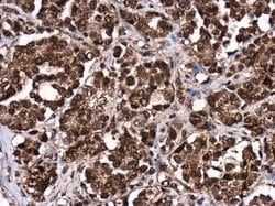 Invitrogen LIN28B Polyclonal Antibody 100 &mu;L; Unconjugated:Antibodies,