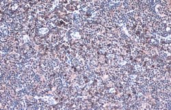 Invitrogen IL-32 Polyclonal Antibody 100 &mu;L; Unconjugated:Antibodies,