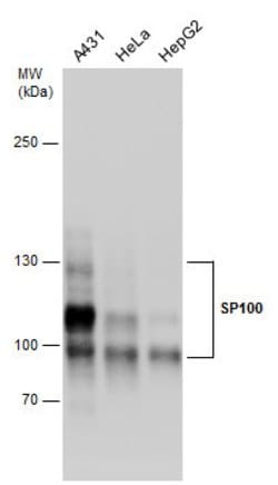 Invitrogen SP100 Polyclonal Antibody 100 &mu;L | Buy Online | Invitrogen&trade; | Fisher Scientific