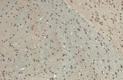 Invitrogen BARD1 Polyclonal Antibody 100 &mu;L | Buy Online | Invitrogen&trade; | Fisher Scientific