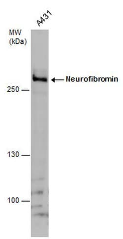 Invitrogen NF1 Polyclonal Antibody 100 &mu;L; Unconjugated:Antibodies,