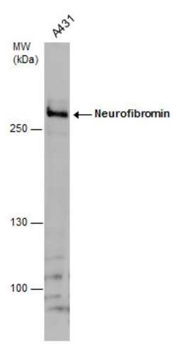Invitrogen NF1 Polyclonal Antibody 100 &mu;L; Unconjugated:Antibodies,