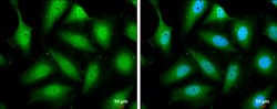 Invitrogen STAT5 beta Polyclonal Antibody 100 &mu;L; Unconjugated:Antibodies,