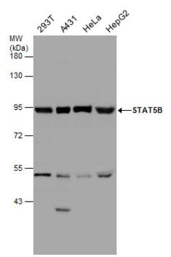 Invitrogen STAT5 beta Polyclonal Antibody 100 &mu;L; Unconjugated:Antibodies,