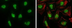 Invitrogen BRG1 Polyclonal Antibody 100 &mu;L; Unconjugated:Antibodies,