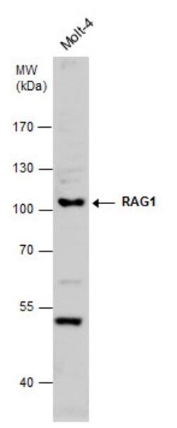 Invitrogen RAG1 Polyclonal Antibody 100 &mu;L; Unconjugated:Antibodies,