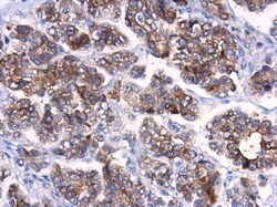 Invitrogen ATG10 Polyclonal Antibody 100 &mu;L; Unconjugated:Antibodies,