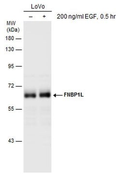 Invitrogen TOCA-1 Polyclonal Antibody 100 &mu;L; Unconjugated:Antibodies,