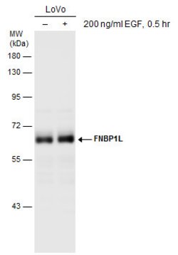Invitrogen TOCA-1 Polyclonal Antibody 100 &mu;L; Unconjugated:Antibodies,