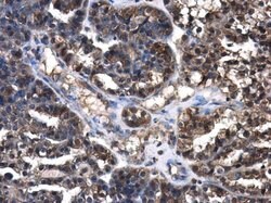 Invitrogen Cystatin C Polyclonal Antibody 100 &mu;L | Buy Online | Invitrogen&trade; | Fisher Scientific