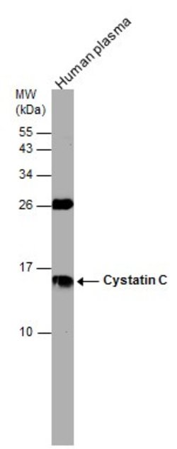 Invitrogen Cystatin C Polyclonal Antibody 100 &mu;L | Buy Online | Invitrogen&trade; | Fisher Scientific