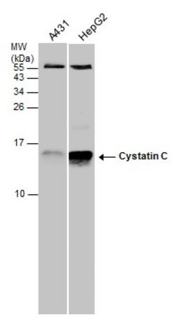 Invitrogen Cystatin C Polyclonal Antibody 100 &mu;L | Buy Online | Invitrogen&trade; | Fisher Scientific