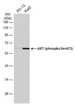 Invitrogen Phospho-AKT1 (Ser473) Polyclonal Antibody 100 &mu;L; Unconjugated:Antibodies,