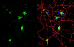 Invitrogen BDNF Polyclonal Antibody 100 &mu;L; Unconjugated:Anticorps,