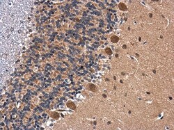 Invitrogen BDNF Polyclonal Antibody 100 &mu;L; Unconjugated:Anticorps,