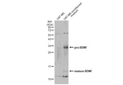 Invitrogen BDNF Polyclonal Antibody 100 &mu;L; Unconjugated:Anticorps,