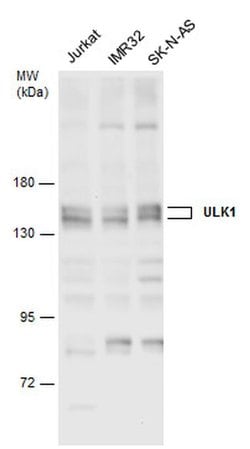 Invitrogen ULK1 Polyclonal Antibody 100 &mu;L; Unconjugated:Antibodies,