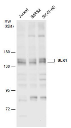Invitrogen ULK1 Polyclonal Antibody 100 &mu;L; Unconjugated:Antibodies,