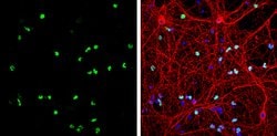 OLIG2 Polyclonal Antibody:Antibodies, Polyclonal