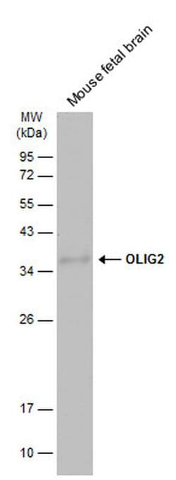 OLIG2 Polyclonal Antibody:Antibodies, Polyclonal