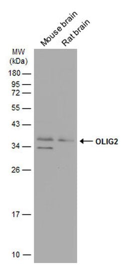 OLIG2 Polyclonal Antibody:Antibodies, Polyclonal
